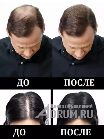 Загуститель для волос, Москва