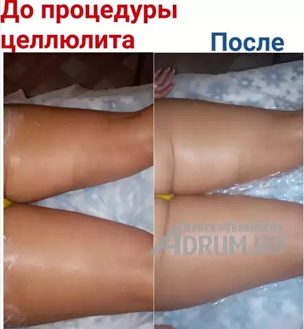 Общий массаж тела в Подольске, фото 17